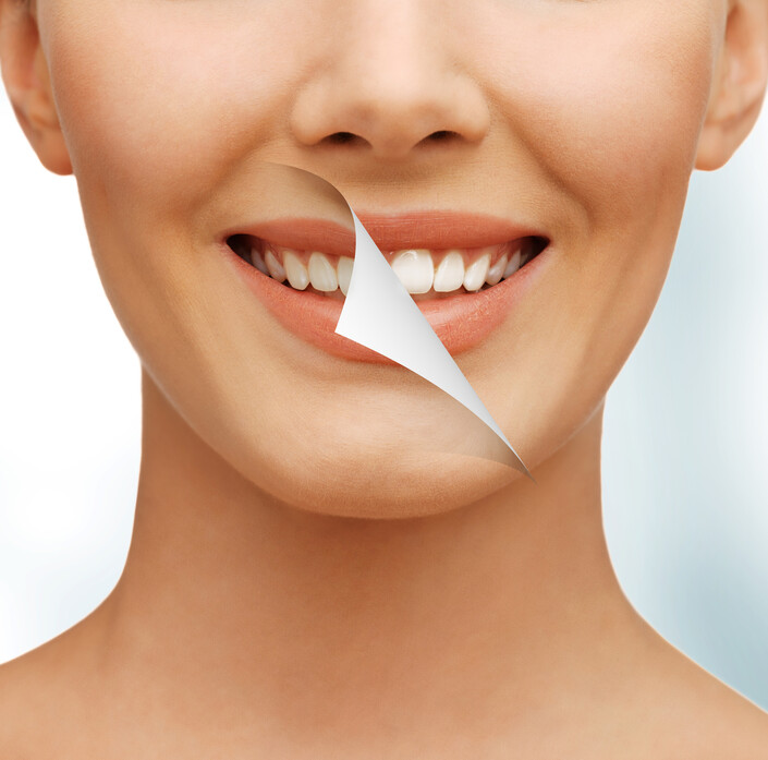 Czytaj więcej: Wybielanie zębów – FAQ, czyli odpowiedzi na najczęstsze pytania